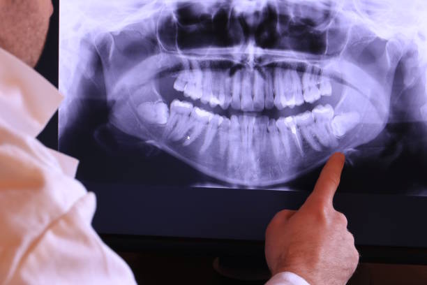 Best Emergency Dental Care for Trauma or Injury in Mshall, AR