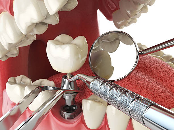 Best Emergency Dental Surgery in Mshall, AR